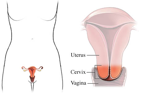 cervix image
